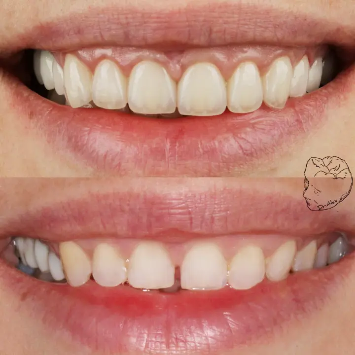 Dentálna hygiena SK